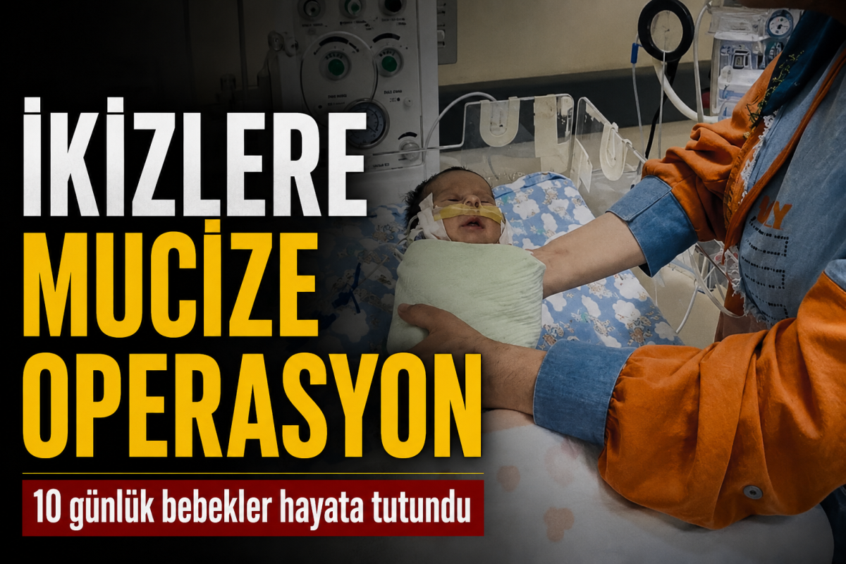 10 Günlük İkizlere Hayat Veren Operasyon